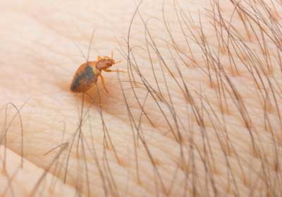 Bed bug bite; D's Pest Control -Bed Bug Exterminators